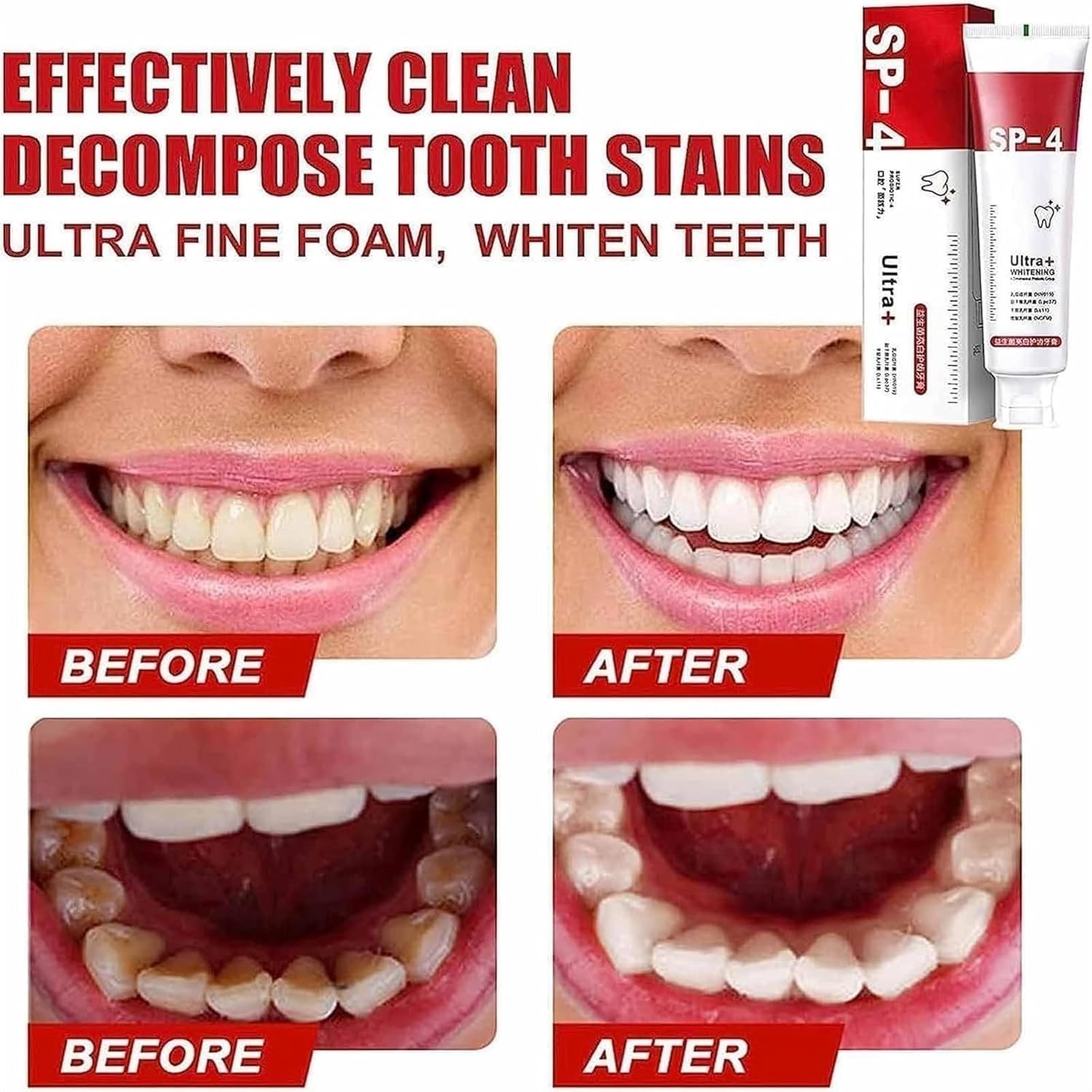 Yayashi Sp-4 Ultra Whitening Toothpaste - Image 2